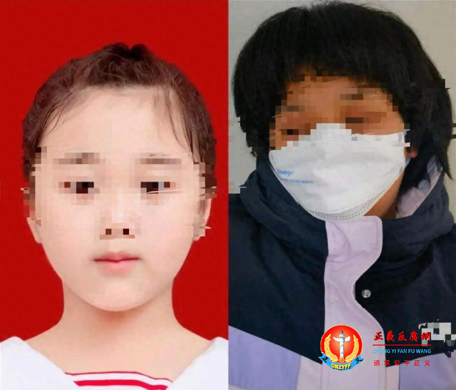 9岁女孩受伤前后对比.png 9岁女孩受伤前后对比.png